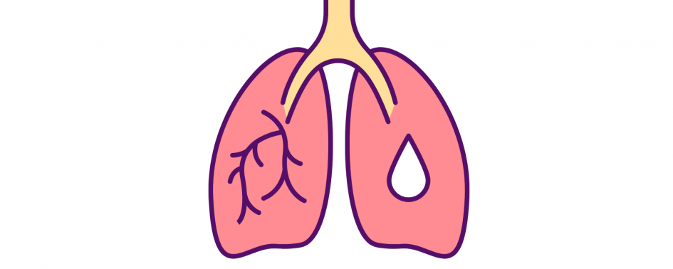 Lunger bakteriedyrkning