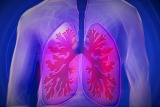 2017: gode tall for lungetransplantasjoner